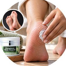 dry cracked heels treatment​