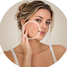 What Is The Skin Barrier? How To Know If the Skin Barrier Is Damaged