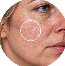 why is my skin cracking​